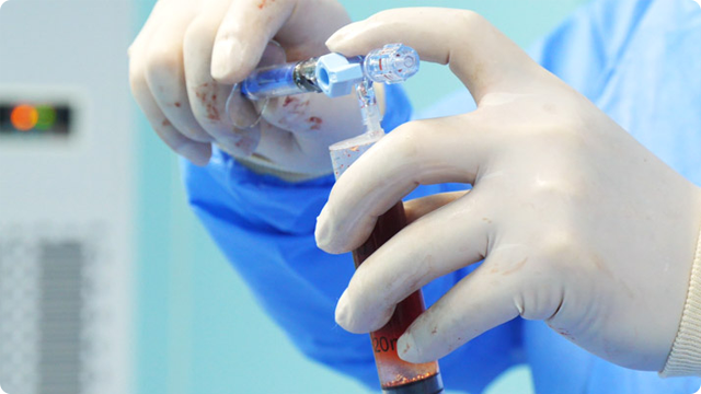 介入载药栓塞微球疗法